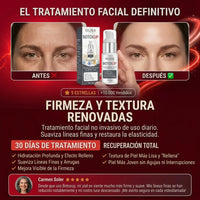 Crema Antiarrugas BotoxUp